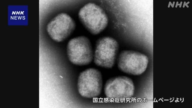 「エムポックス（サル痘）」 新たにスウェーデンで感染を確認